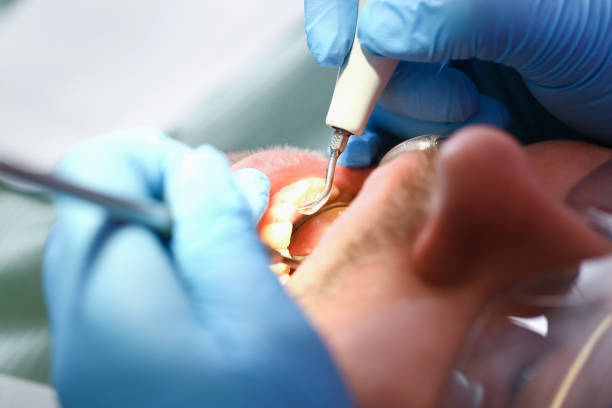 Best Emergency Treatment for Oral Infections in Eastland, TX