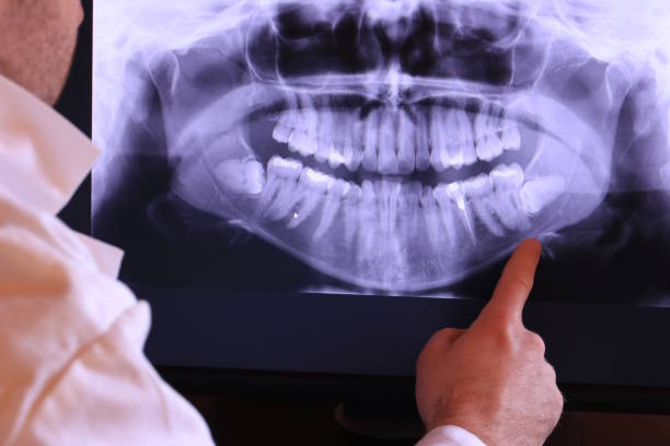Best Knocked-Out Tooth (Avulsed Tooth) Treatment in Eastland, TX